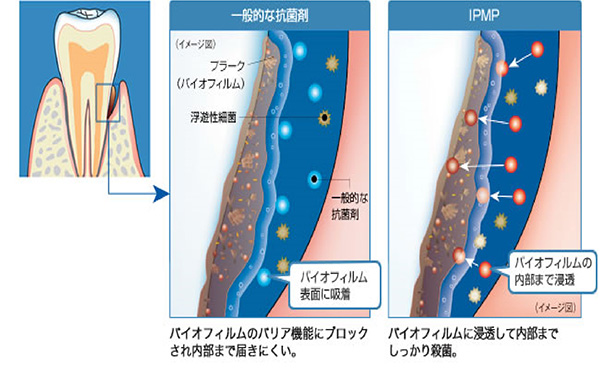 Зубная паста Systema IPMP для лечения дёсен от японской компании Lion-Dent 